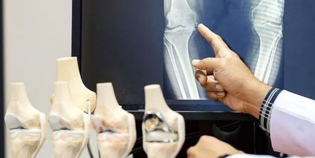 Foto - Kemik ve diş sağlığı için kalsiyum zengini en iyi 13 gıda