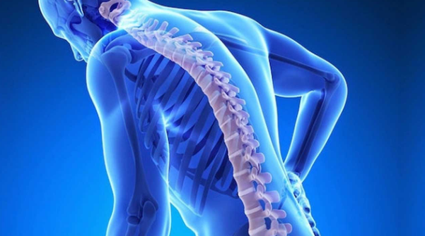 Kemikleri çelik gibi yapacak yöntem! Kemik erimesini önlemek için mutlaka bunları yapın