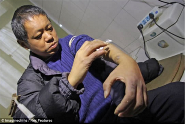 Foto - Kendi diyaliz makinesini yaptı