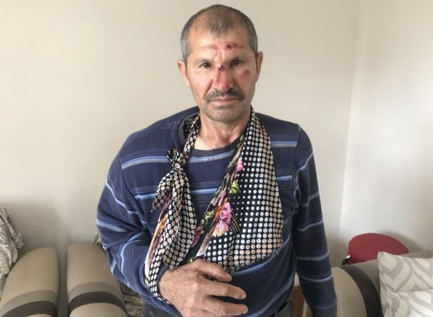 Foto - Kendisine çarpan aracın parçalarını delil olarak evine götürdü