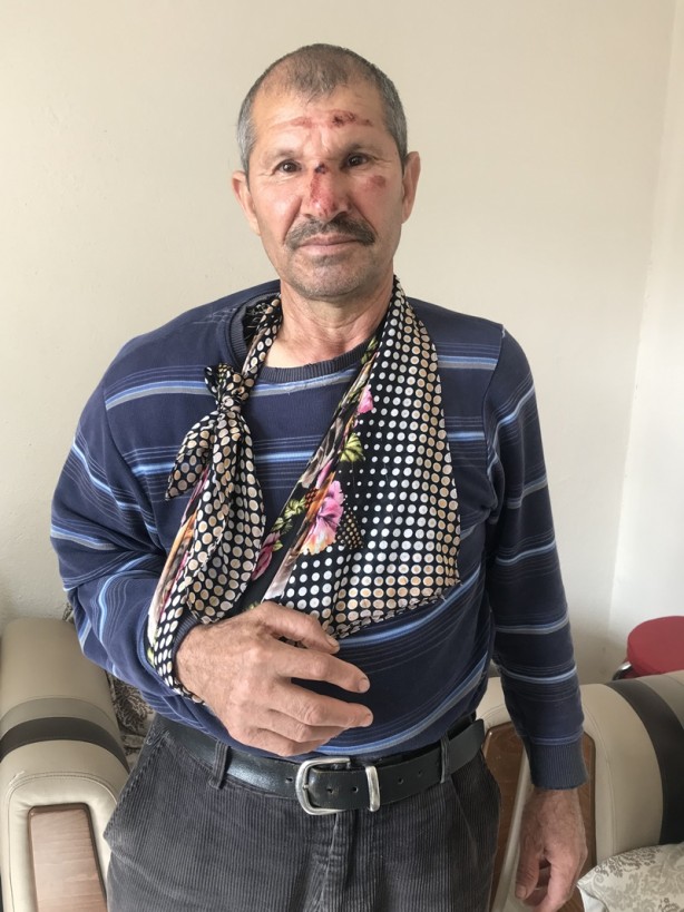 Foto - Kendisine çarpan aracın parçalarını delil olarak evine götürdü