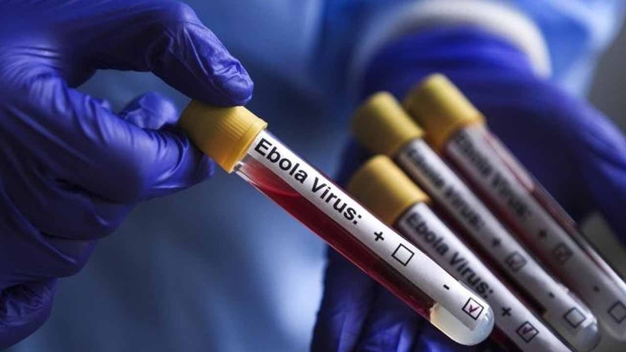Foto - Kenya'da ilk ebola ölümü: Salgın kapıda mı?