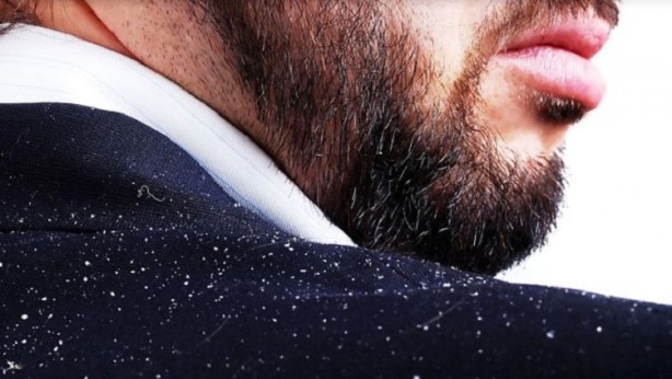 Kepek oluşumunun nedenleri ve kurtulmak için ipuçları