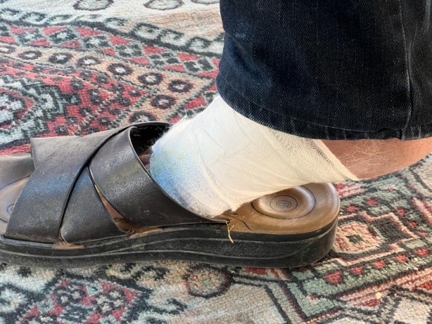 Foto - Kesilecek denen ayak merhemle iyileşti