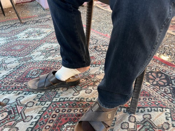 Foto - Kesilecek denen ayak merhemle iyileşti