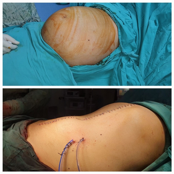 Foto - Kilo aldığını sanıyordu... Karnından çıkanlar şoke etti