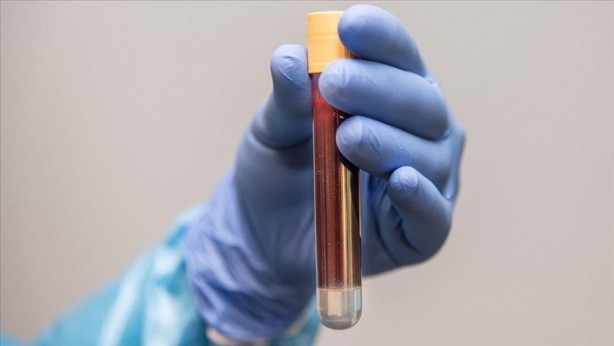 Foto - Kilo veremeyip sürekli üşüyenler dikkat! O hastalığın habercisi…