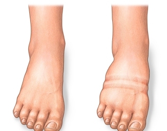 Foto - Kilo verince vücudumuzda neler olur?