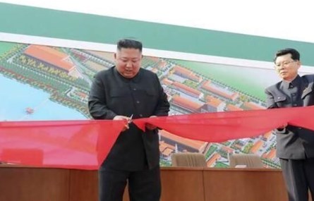 Foto - Kim’in sağ eline radial arter anevrizması uygulandığı belirtildi. Babası ve dedesinin kalp krizinden öldüğünü hatırlatan NK News isimli medya kuruluşuna konuşan doktorlar şu iddiada bulundu: