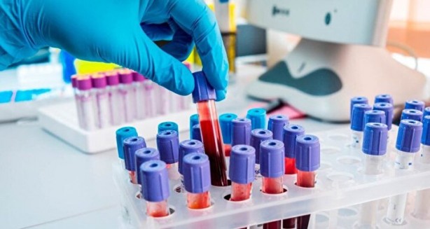 Foto - Kimisi olumlu kimisi olumsuz! Kan grubuna göre kişilik modelleri