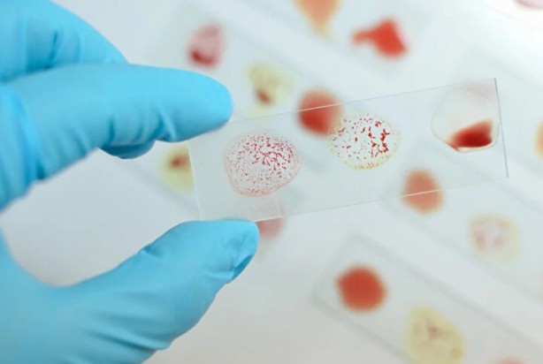 Foto - Kimisi olumlu kimisi olumsuz! Kan grubuna göre kişilik modelleri