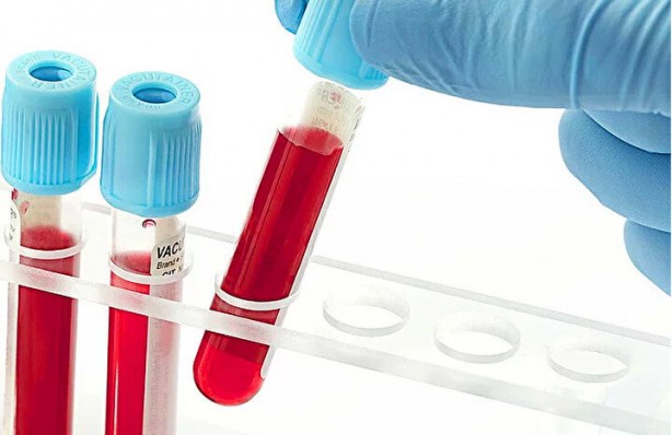 Foto - Kimisi olumlu kimisi olumsuz! Kan grubuna göre kişilik modelleri