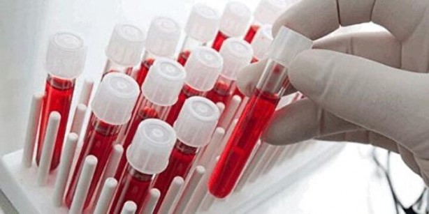 Foto - Kimisi olumlu kimisi olumsuz! Kan grubuna göre kişilik modelleri