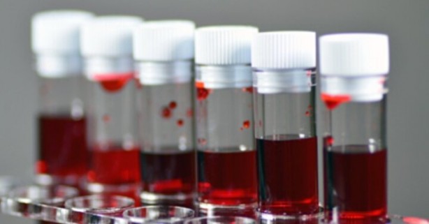 Foto - Kimisi olumlu kimisi olumsuz! Kan grubuna göre kişilik modelleri