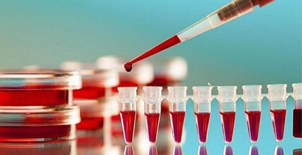 Foto - Kimisi olumlu kimisi olumsuz! Kan grubuna göre kişilik modelleri