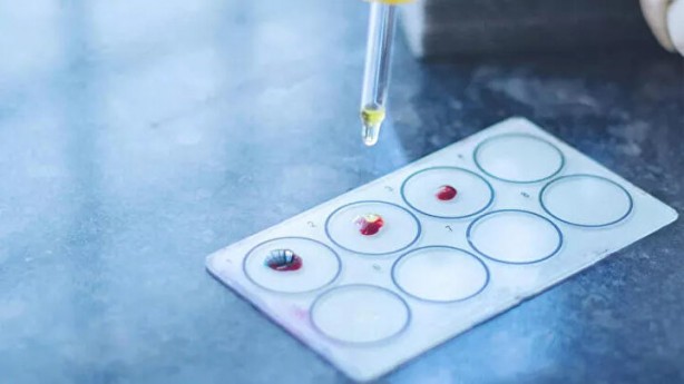 Foto - Kimisi olumlu kimisi olumsuz! Kan grubuna göre kişilik modelleri