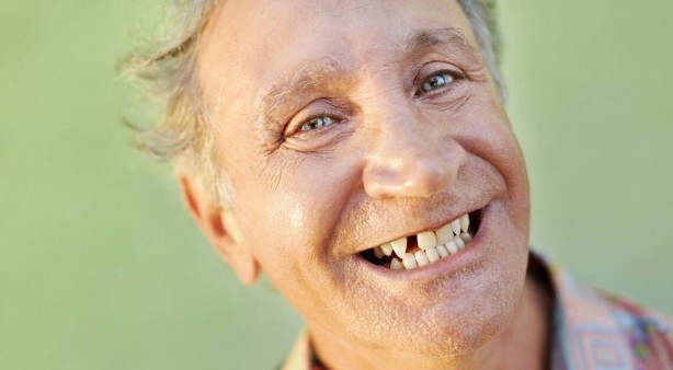 Foto - Kimse farkında değil! Eksik dişler sağlığımızı nasıl etkiler