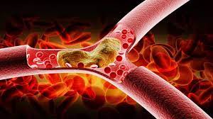 Foto - Kimse paylaşmamıştı, 1 bardak suya 1 tatlı kaşığı eklemek yeterliymiş, gerçek ortaya çıktı! Bakın ne! 