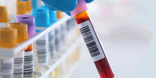 Foto - Kırmızı et tüketenler dikkat! Bu hatayı yaparsanız...