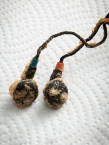 Foto - Kızarmış 'teknoloji' yer miydiniz?