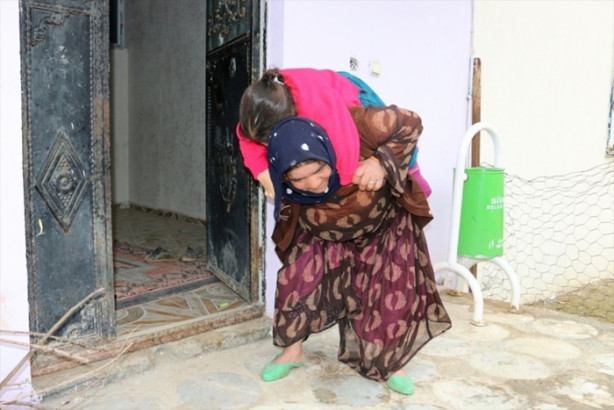 Foto - Kızını 36 senedir sırtında taşıyor