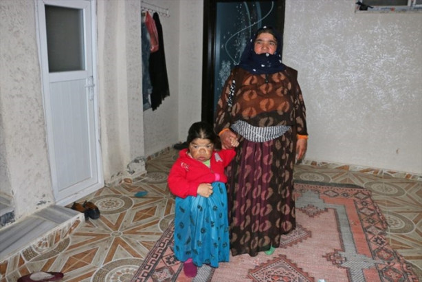 Foto - Kızını 36 senedir sırtında taşıyor