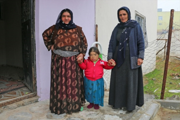 Foto - Kızını 36 senedir sırtında taşıyor