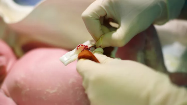 Foto - Koç Grubu doymuyor! Ünlü sağlık kuruluşunu satın alıyor