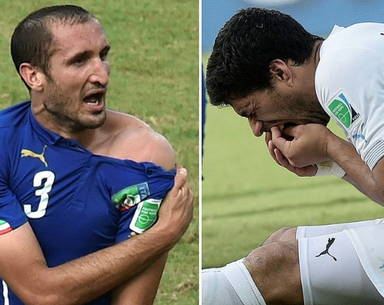 Foto - Kocaelispor-Altay maçında Luis Suarez vakası! Yok artık daha neler: 1. Lig'de bunu da gördük...