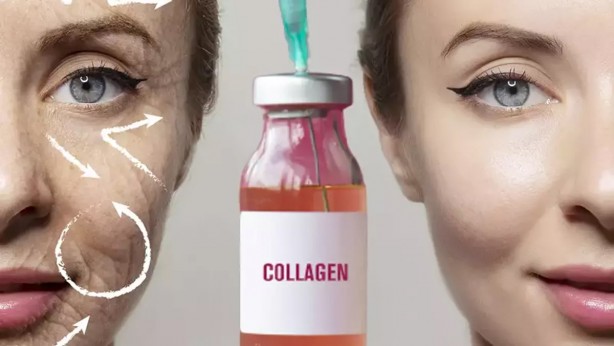 Foto - Kolajen haplarına para dökmeyin! 1 kaşığı 1 kutu kolajenden daha güçlü: Gençlik aşısı etkisiyle kırışıklıkları dolduruyor