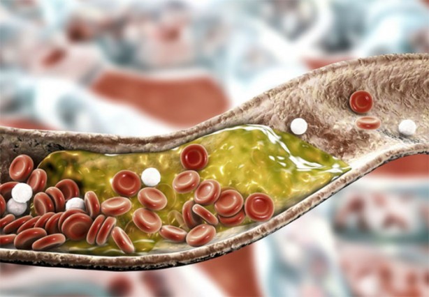 Kolesterole karşı koyan 7 besin grubu
