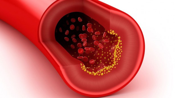Foto - Kolesterole karşı koyan 7 besin grubu