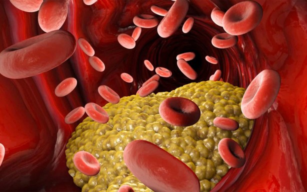 Foto - Kolesterole karşı koyan 7 besin grubu