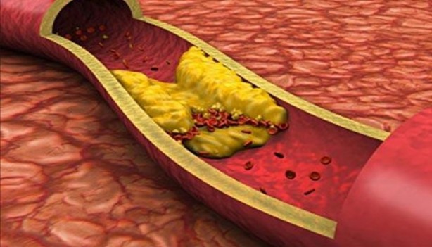 Kolestrolü düşüren tek balık buymuş Uzmanlar üstüne basa basa uyardı