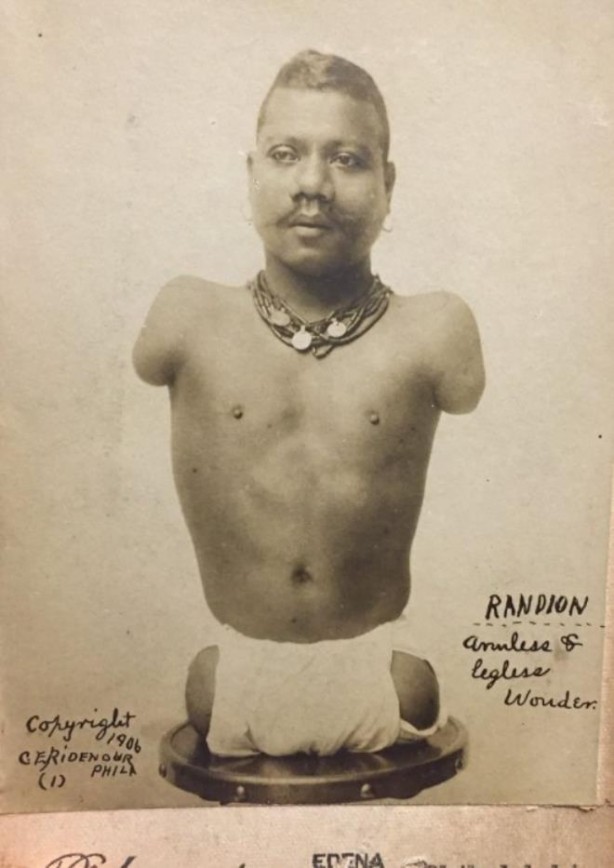 Foto - Kolları ve bacakları olmadan doğan Prens Randian'ın bıraktığı servet dudak uçuklattı