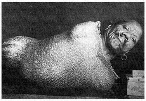 Foto - Kolları ve bacakları olmadan doğan Prens Randian'ın bıraktığı servet dudak uçuklattı