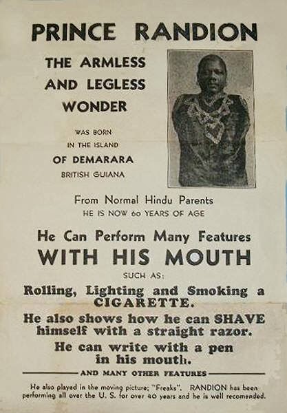 Foto - Kolları ve bacakları olmadan doğan Prens Randian'ın bıraktığı servet dudak uçuklattı