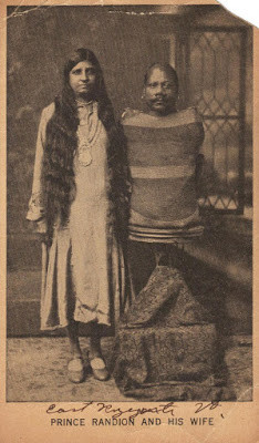 Foto - Kolları ve bacakları olmadan doğan Prens Randian'ın bıraktığı servet dudak uçuklattı