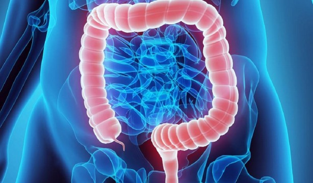 Foto - Kolon kanserinden korunmak için böyle beslenin