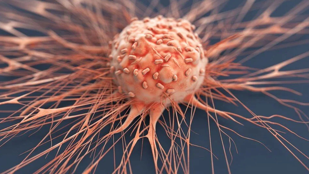 Foto - Bu kanser türü aylar öncesinden geliyorum diyor! İşte gizli 5 belirtisi buymuş