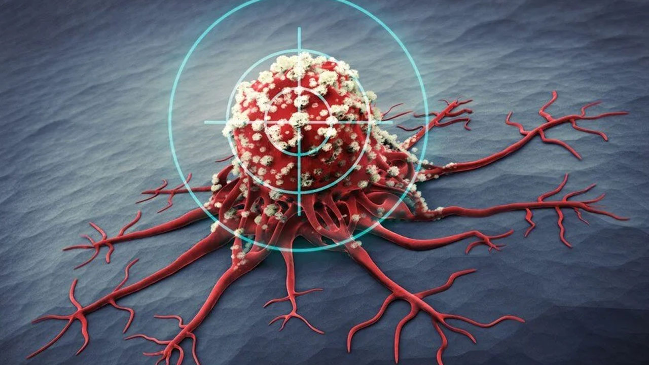 Foto - Bu kanser türü aylar öncesinden geliyorum diyor! İşte gizli 5 belirtisi buymuş