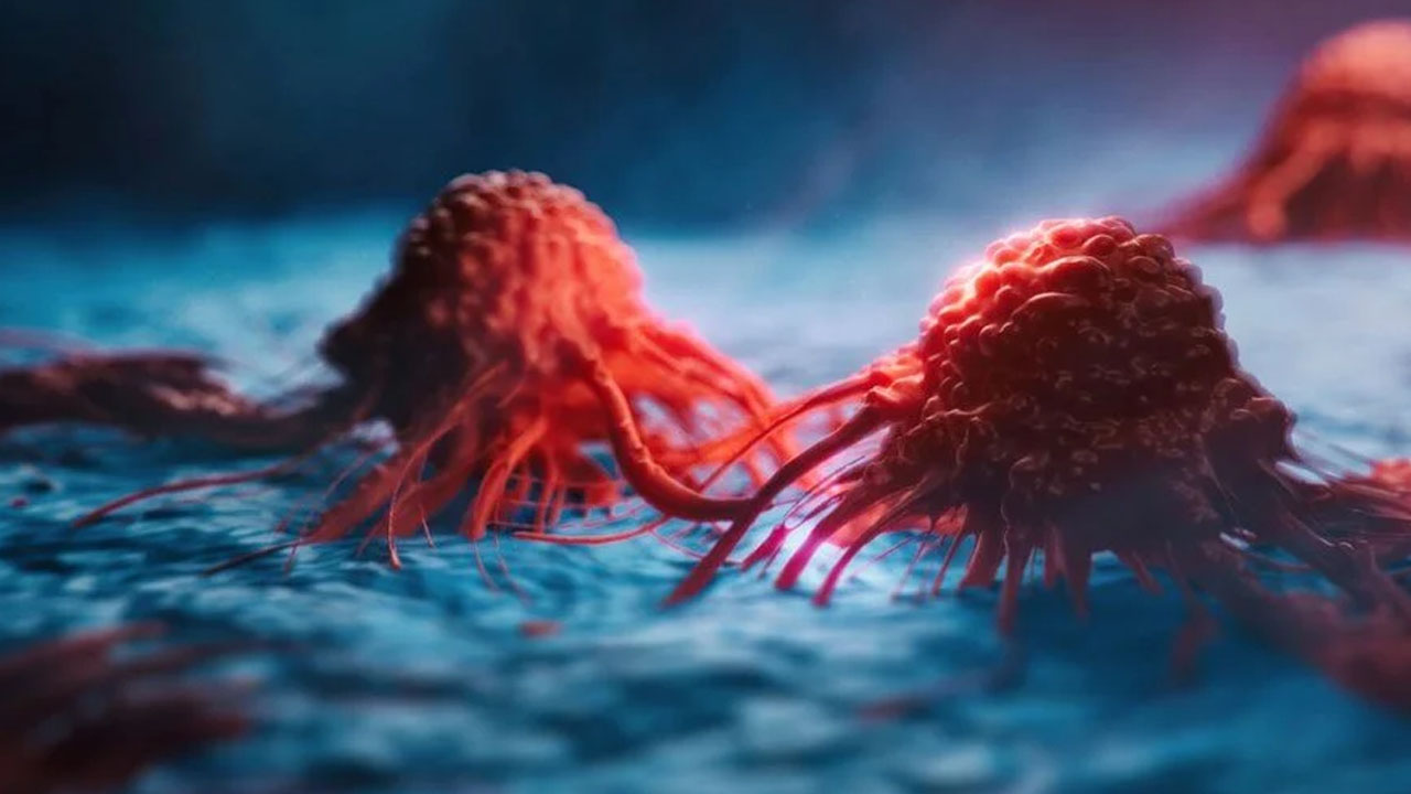 Foto - Bu kanser türü aylar öncesinden geliyorum diyor! İşte gizli 5 belirtisi buymuş