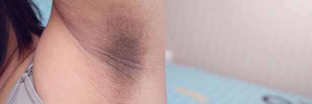 Foto - Koltuk altına zeytinyağlı sabun sürünce bakın ne oluyor! Herkes denemeye başladı