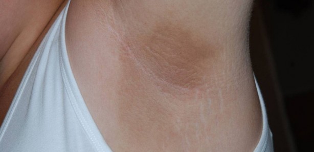 Foto - Koltuk altına zeytinyağlı sabun sürünce bakın ne oluyor! Herkes denemeye başladı