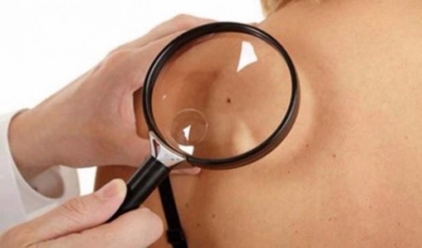 Kolunuzda 11'den fazla ben varsa...