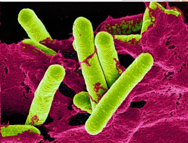 Foto - Konservede ölümcül risk!