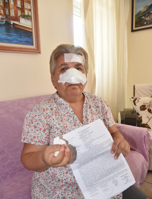 Foto - Köpekler kalıcı hasar bıraktı! 55 yaşındaki kadın ölümle burun buruna geldi