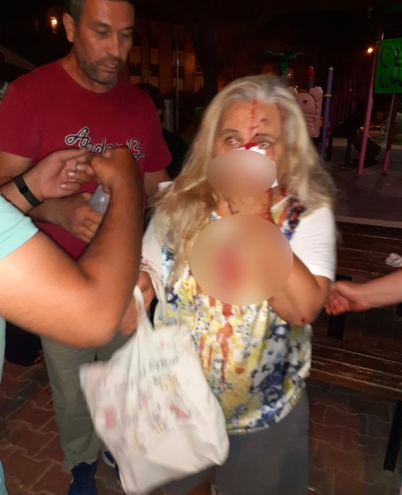 Köpekler kalıcı hasar bıraktı! 55 yaşındaki kadın ölümle burun buruna geldi