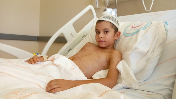 Foto - Köpeklerin saldırısında yaralanmıştı! O çocuk 22 gün sonra taburcu oldu