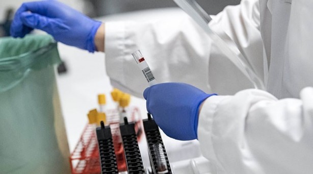 Foto - Korkunç haber geldi! Aman dikkat... Koronavirüsün yeni bir bulaşma şekli ortaya çıktı